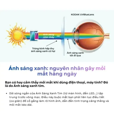 Tròng Kính Mỏng Chống Ánh Sáng Xanh Blue Lens Kodak 1.60